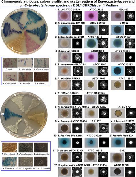 color of tuberculosis colonies on agar media